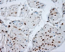 NPR3 Antibody (clone OTI4C3)