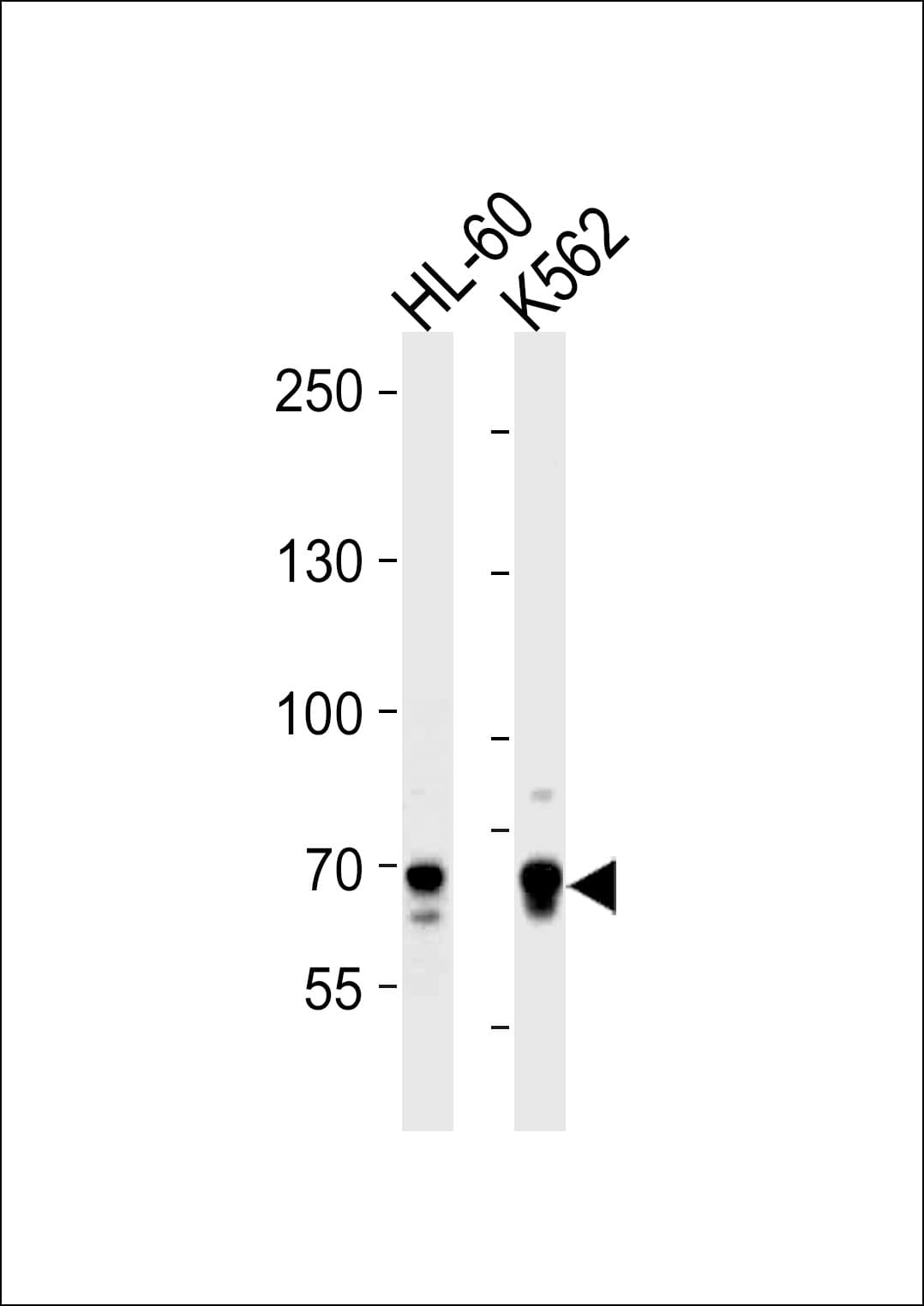 IHC-plus™ ELF4 / MEF Antibody (aa211-237)