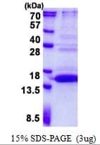 Human UFSP1 Protein (Recombinant His)
