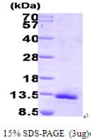 Human CCL11 / Eotaxin Protein (Recombinant His)