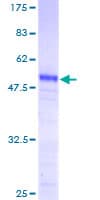 Human PRKRIP1 Protein (Recombinant GST)