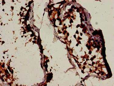BCL2L11 / BIM Antibody