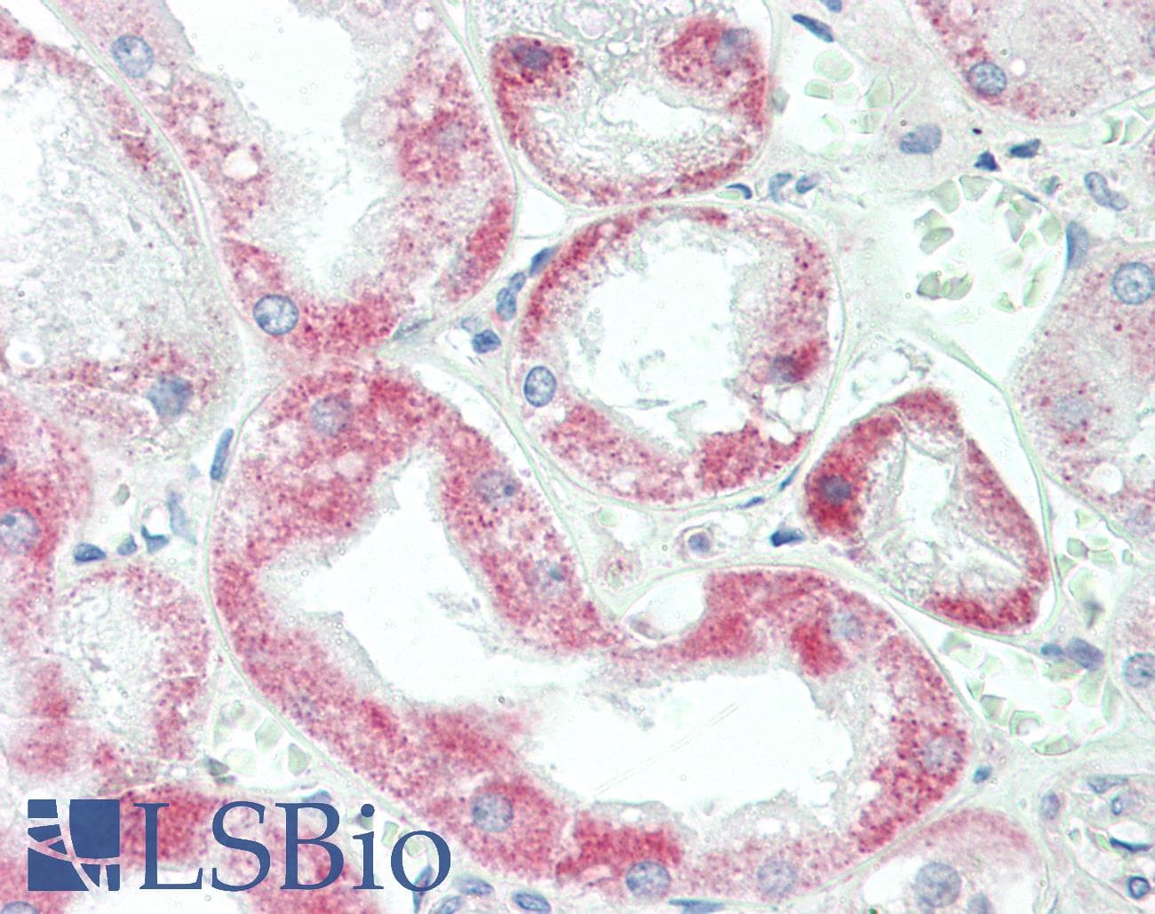 IHC-plus™ YTHDF1 Antibody (aa1-50)
