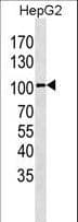 GPR49 / LGR5 Antibody (aa443-473)