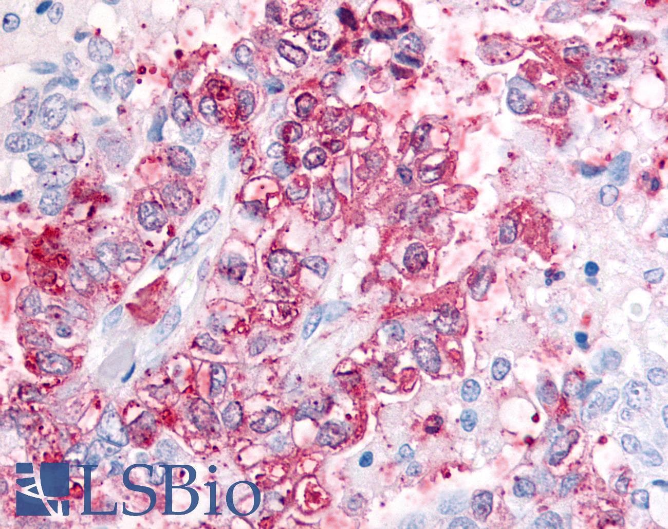 PathPlus™ Polyclonal Rabbit anti-Human WNT10A Antibody (Internal, IHC)