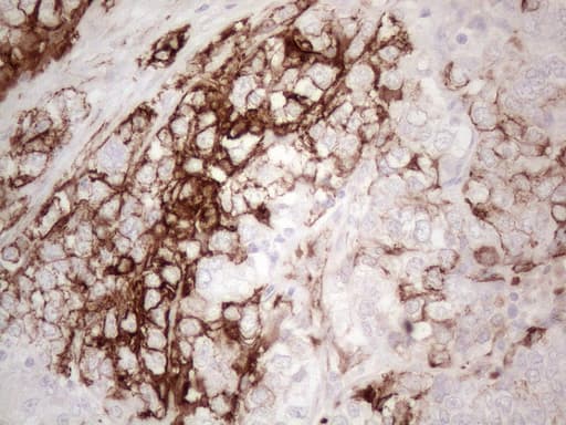 KRT16 / CK16 / Cytokeratin 16 Antibody (clone OTI2H8)