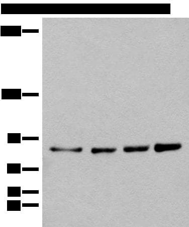 Polyclonal Rabbit anti-Human PIBF1 / PIBF Antibody (IHC, WB)