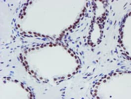 METTL16 / METT10D Antibody (clone OTI3B5)