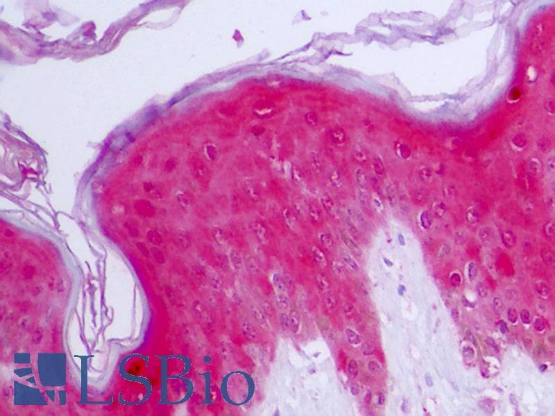 IHC-plus™ IL1RN Antibody