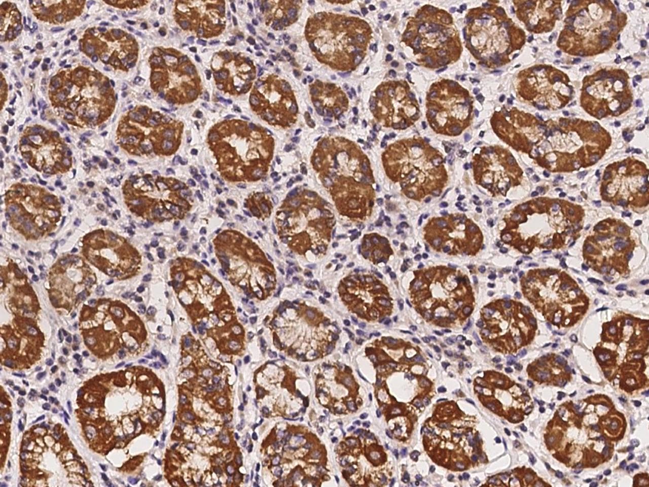 RAB39B Antibody