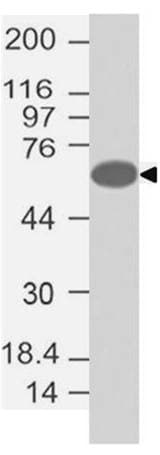 FOXC1 Antibody