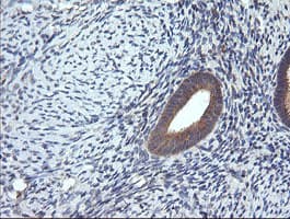 TCL / RHOJ Antibody (clone OTI2C9)