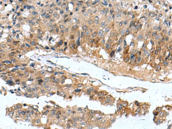 Polyclonal Rabbit anti-Human PDCD5 Antibody (IHC)