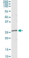 NME5 Antibody (clone 4F5)