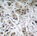 AKT1 Antibody