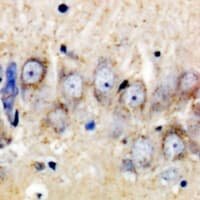 Polyclonal Rabbit anti-Human CHPF2 / CSGLCAT Antibody (IHC, WB)