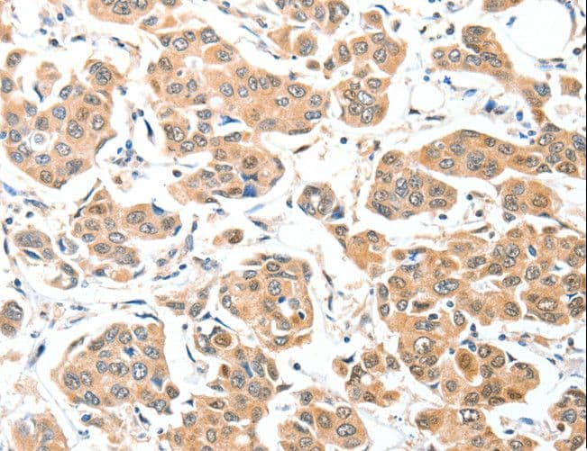 ADCK1 Antibody