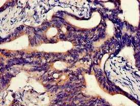 ABCA5 Antibody