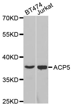ACP5 / TRAP Antibody