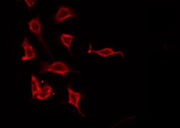 PTH / Parathyroid Hormone Antibody