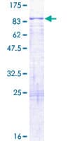 Human KLHL8 Protein (Recombinant GST)