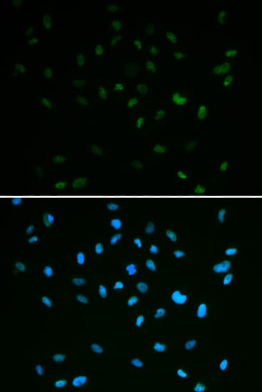 MSH6 Antibody