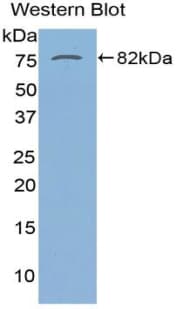 SERPINA10 / PZI Antibody (aa22-448)