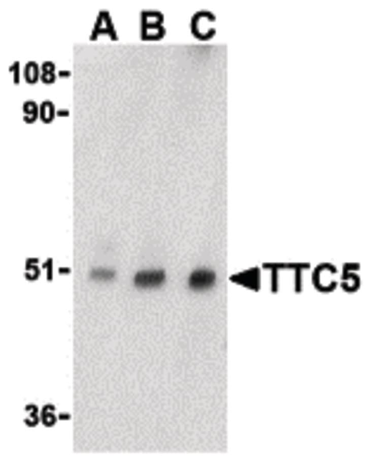 Polyclonal Rabbit anti-Human TTC5 Antibody (IHC, IF, WB)