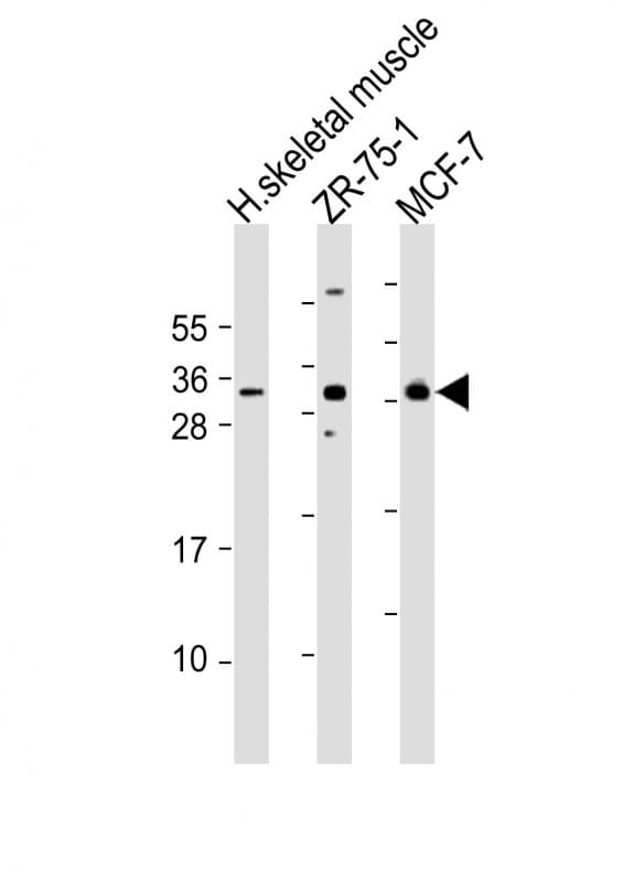 FGF17 Antibody (aa78-112)