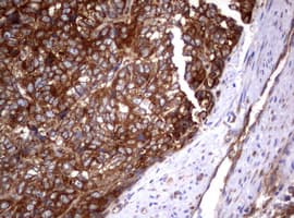 PIK3C2A Antibody (aa230-560, clone OTI3F8)