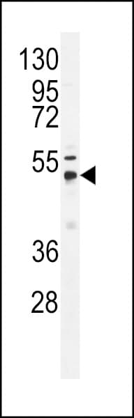 Polyclonal Rabbit anti-Human USP21 Antibody (aa406-436, IHC, WB)