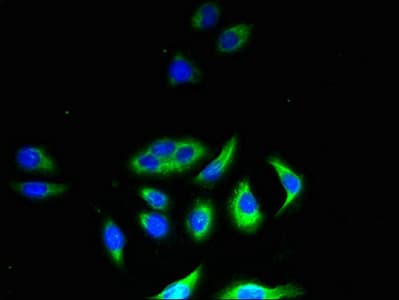 CSF1 / MCSF Antibody (aa33-554)