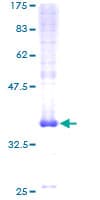 Human TMEM230 Protein (Recombinant GST)