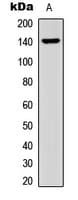 IHC-plus™ COL15A1 / Collagen XV Alpha 1 Antibody (C-Terminus)