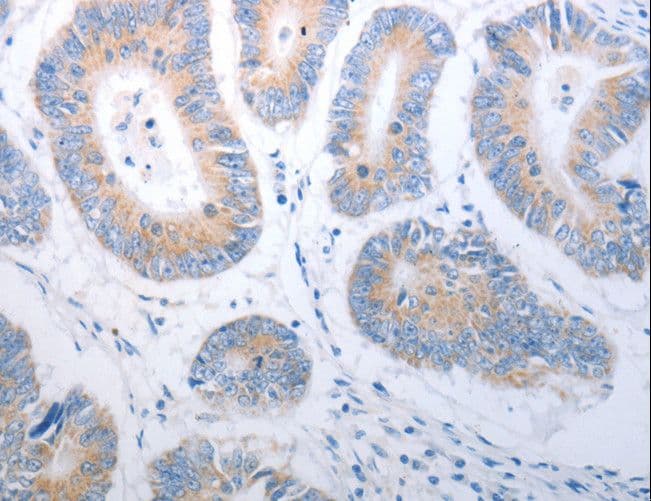 Polyclonal Rabbit anti-Human PAK1 Antibody (IHC, WB)