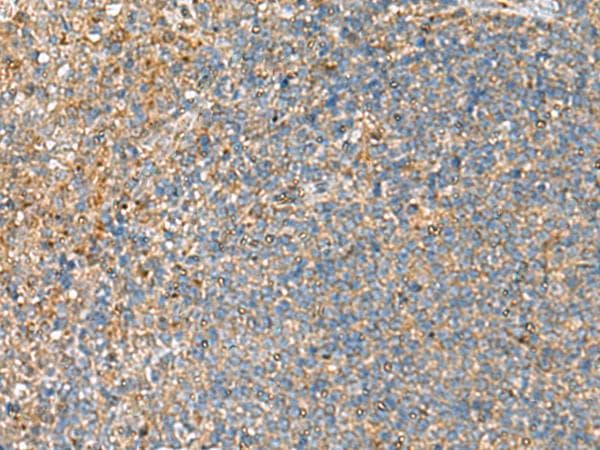 NQO2 Antibody