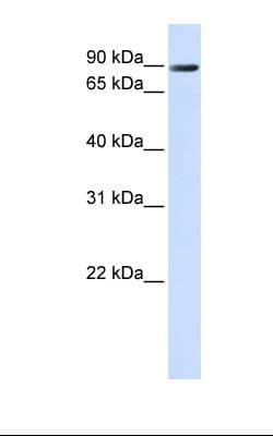 ANO10 / TMEM16K Antibody (aa470-519)