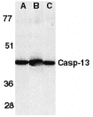 Polyclonal Rabbit anti-Human CASP13 / Caspase 13 Antibody (IHC, WB)
