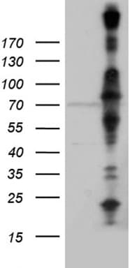 KLC2 Antibody (aa335-622, clone OTI10H10, Carrier-free)