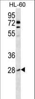 Polyclonal Rabbit anti-Human RHOB Antibody (aa104-137, IHC, WB)
