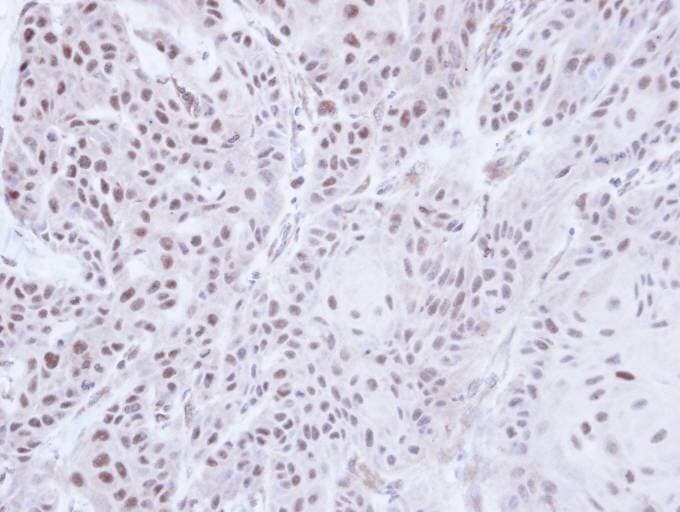 JMJD6 / PSR Antibody (aa1-234)