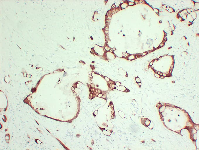 S100A6 / Calcyclin Antibody (clone ABT-S100A6)