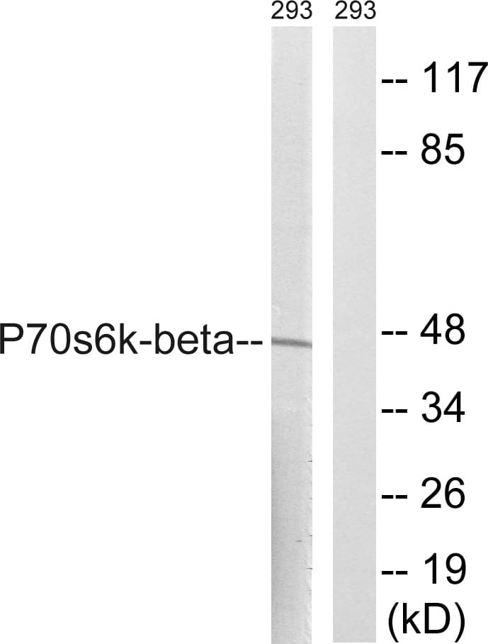Polyclonal Rabbit anti-Human RPS6KB2 / S6K2 Antibody (aa389-438, WB)