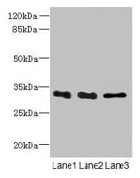 Polyclonal Rabbit anti-Human EXOSC8 Antibody