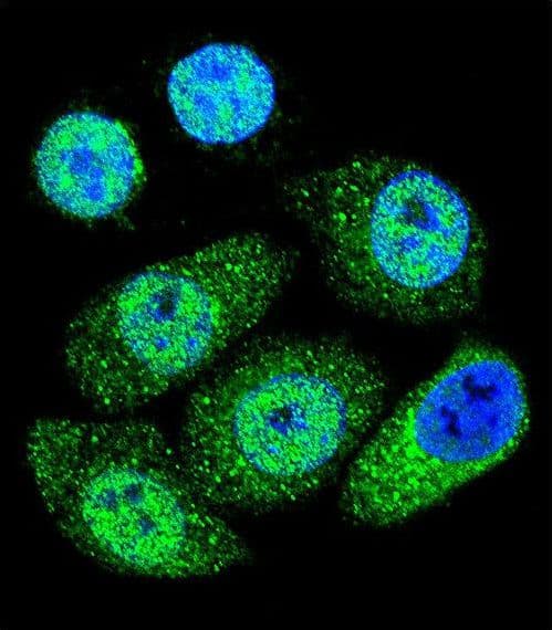 IHC-plus™ Polyclonal Rabbit anti-Human NOS2 / iNOS Antibody (aa830-860, IHC, IF, WB)