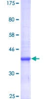 Human ZNT5 / SLC30A5 Protein (Recombinant GST)