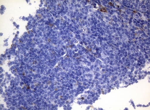 Monoclonal Mouse anti-Human CTSL / Cathepsin L Antibody (clone OTI8C12, Carrier-free, IHC, WB)