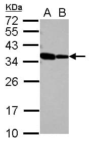 RBM11 Antibody