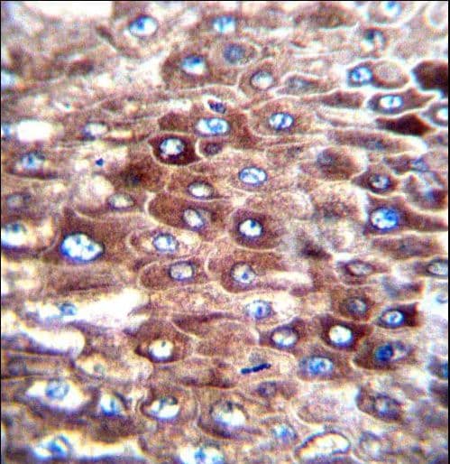 TMEM254 / C10orf57 Antibody (aa96-123)