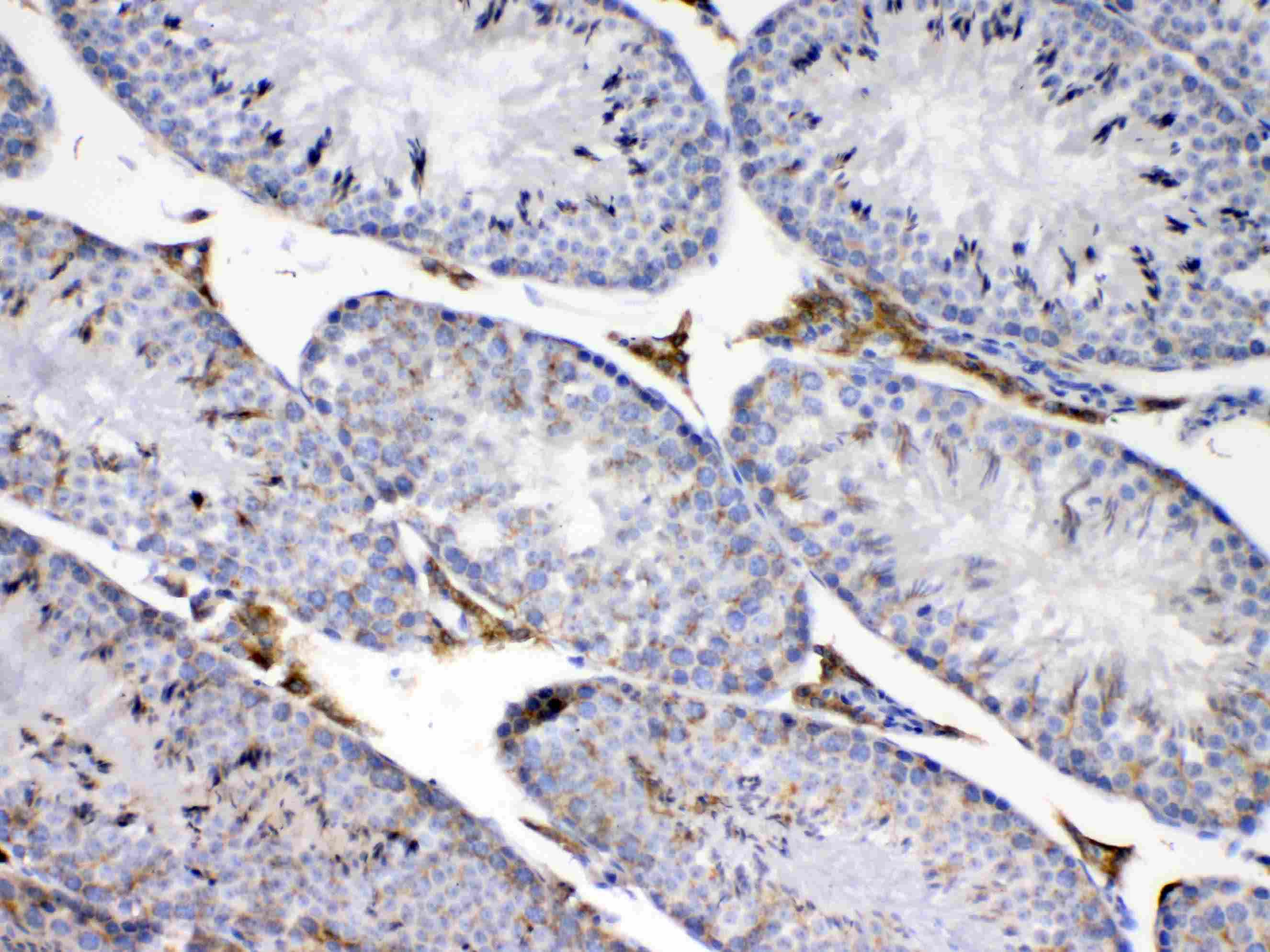 CCP110 Antibody